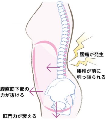 腰がいつも痛い、重い…」の原因は“骨盤の骨ぎわの癒着”かも!? 慢性腰痛を改善する筋膜リリース【川口陽海の腰痛改善教室 第31回】 |