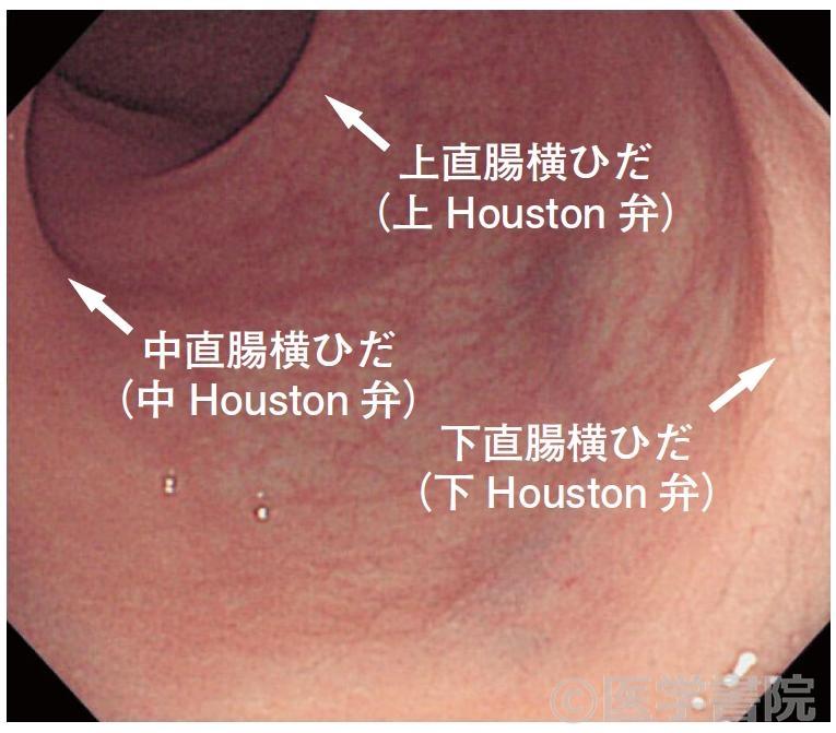 下部消化管 – 腹腔鏡・ロボット支援結腸・直腸がん手術 |